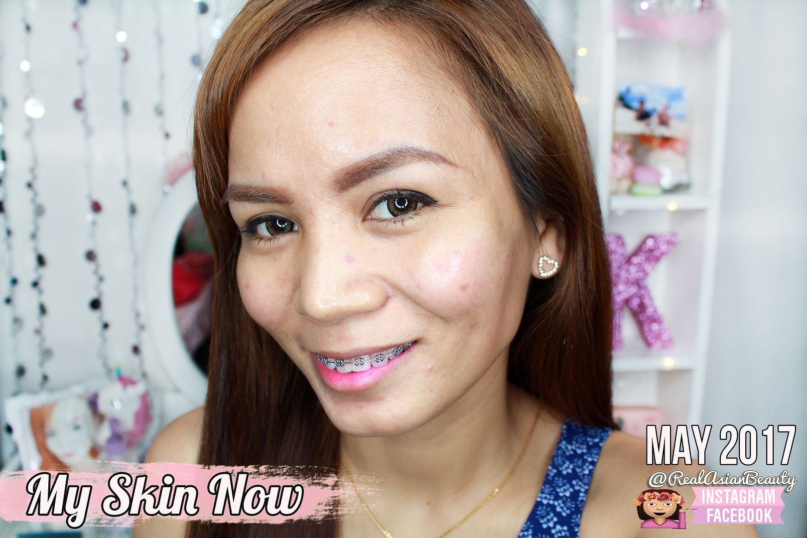 Real Asian Beauty: ESKINOL and DALACIN-C (PROS and CONS of Using It!)